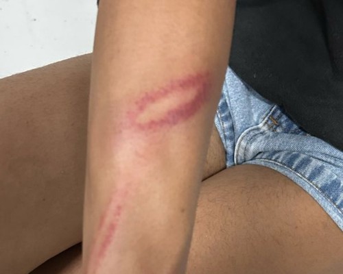 Marido e mulher trans se agridem com socos, tapas, mordidas e pauladas e os dois vão parar na Delegacia